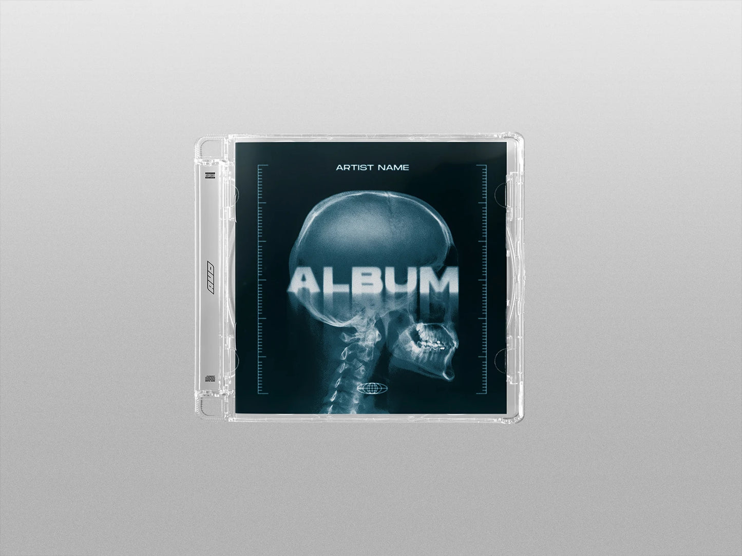 X-Ray