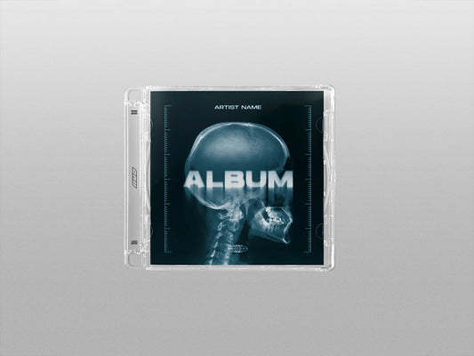 X-Ray